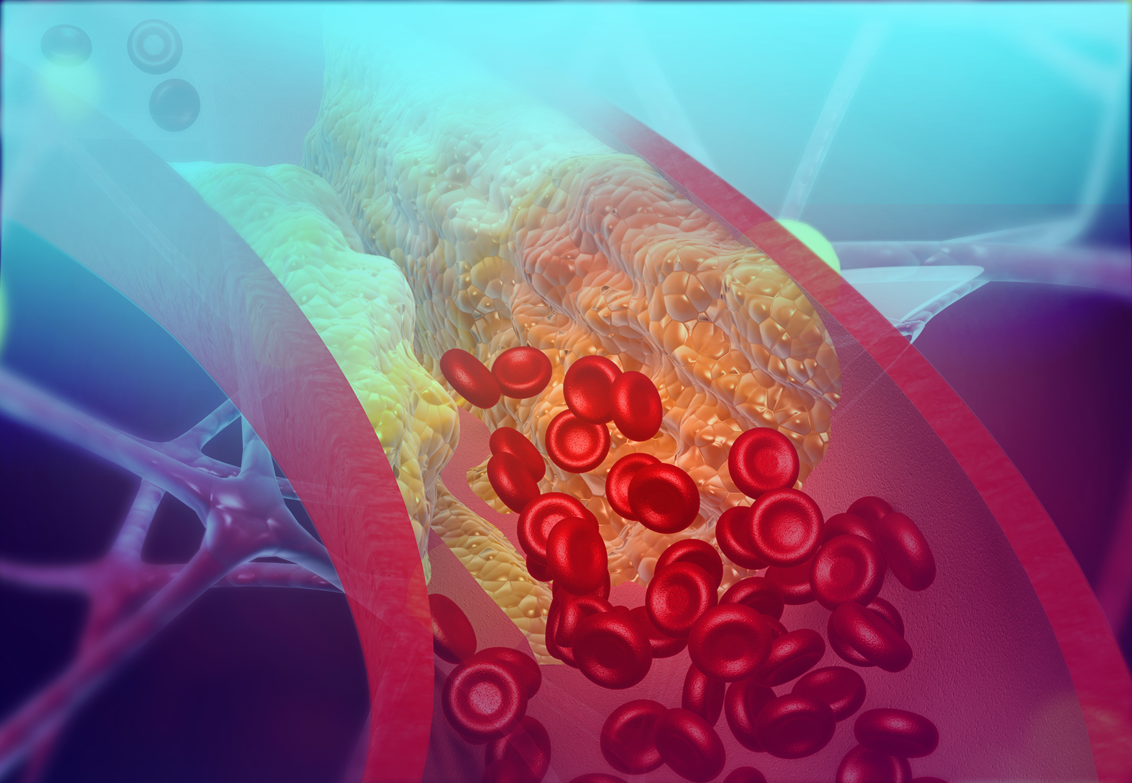 Novel miRNA and Protein Therapeutic Targets to Reduce Atherosclerosis