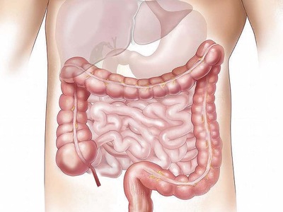 Colo-Cleanse: Colonic Irrigation Solution