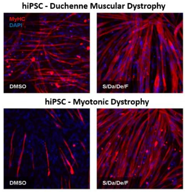 Expression profile of myosin heavy chain isoforms.