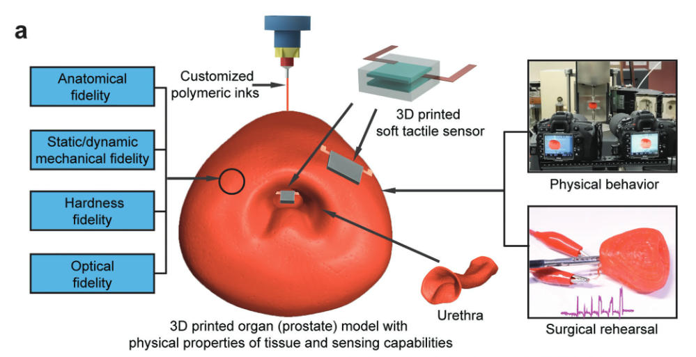 3D  printed  patient-specific  prostate  model