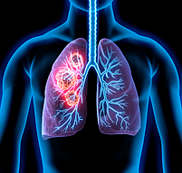 LUNGS LUNGS