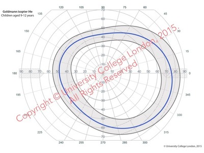 OPTIC study normative perimetry templates