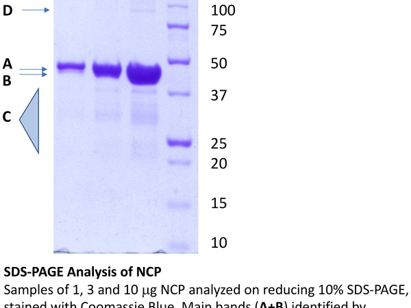 SDS-Page Analysis of NCP