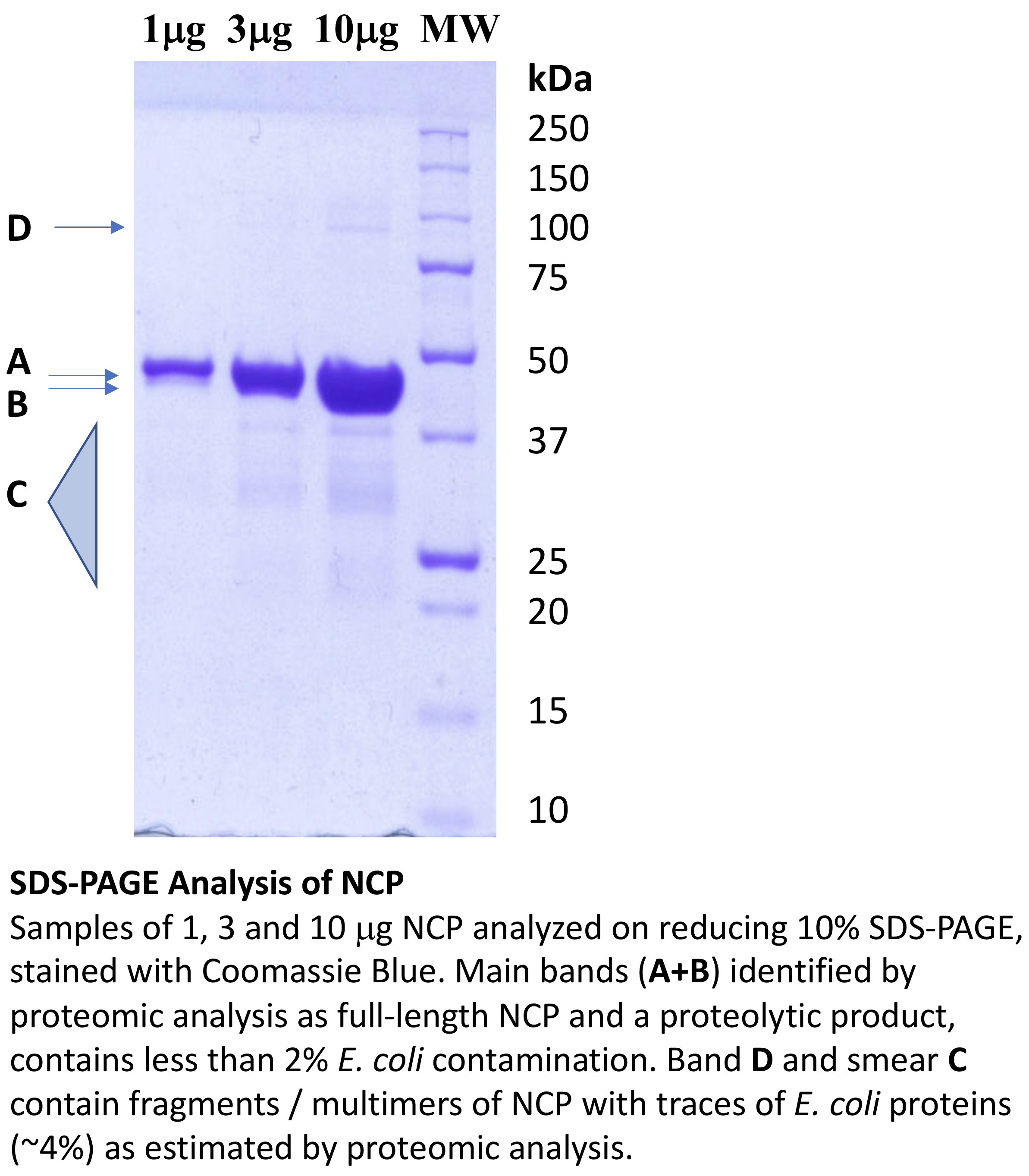 SDS-Page Analysis of NCP SDS-Page Analysis of NCP