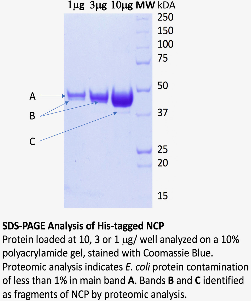 SDS-Page His Tagged NCP SDS-Page His Tagged NCP