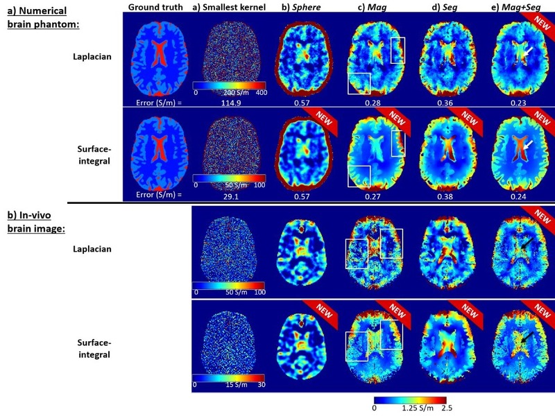 MRI Conductivity