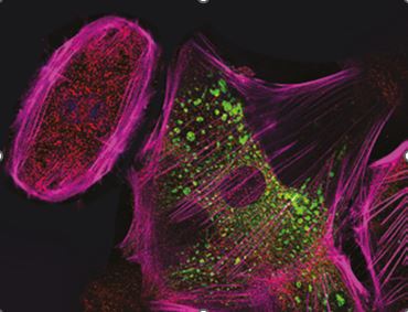 Conditionally Immortalised Human Podocyte Cell Line