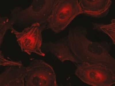 Conditionally Immortalised Proximal Tubular Cell Line