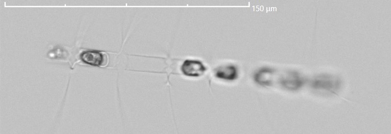 Chaetoceros (Genus) – a centric diatom observed in the Cytosub at EmsoSmartbay October 19th 2024