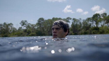 Morsures animales (5).jpg