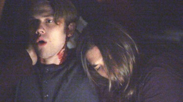 Morsures animales (6).jpg