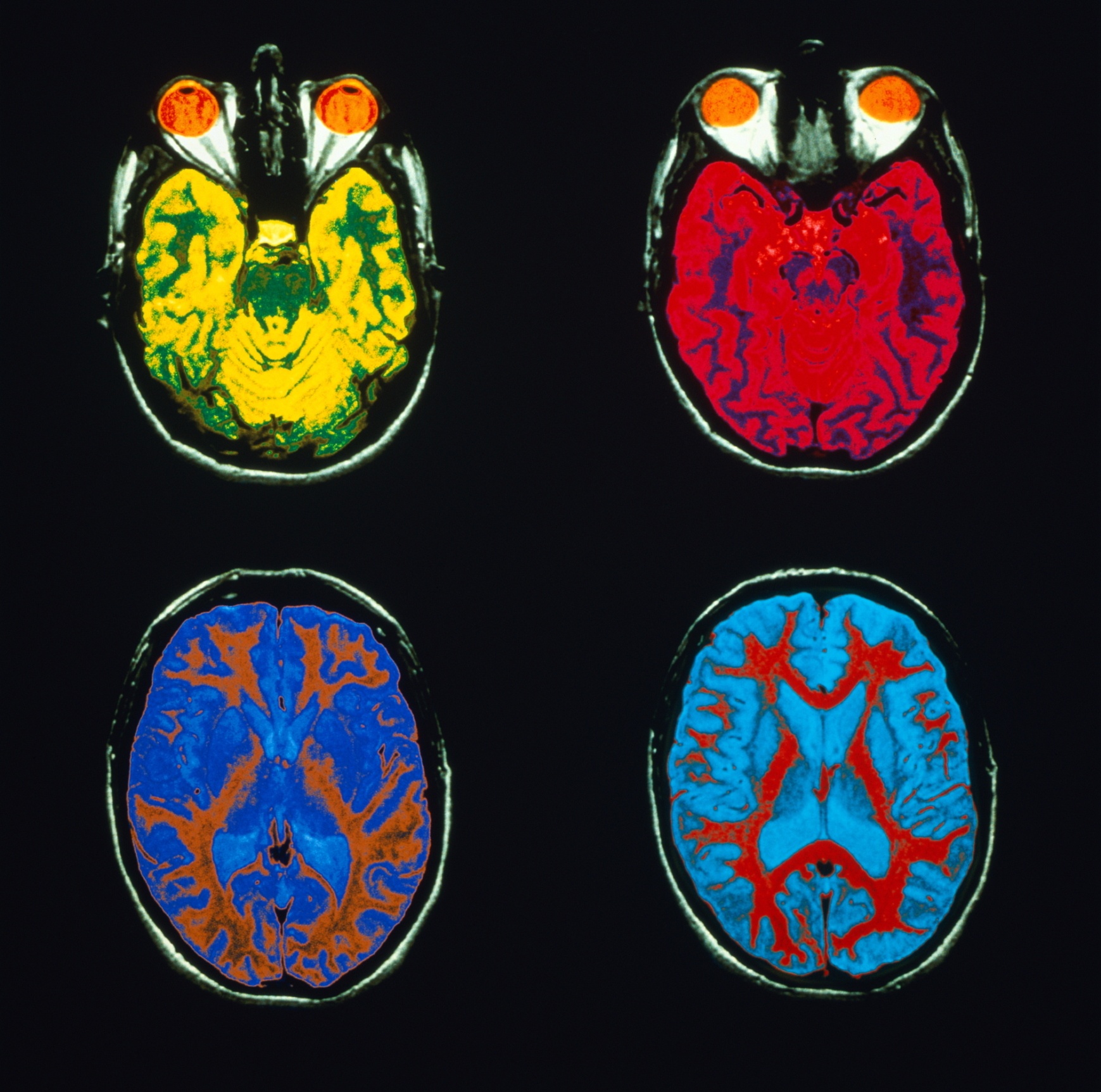 Brain Games  Essaie de me convaincre (2).JPG