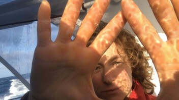 [PHOTO] Les mains abîmées d'Isabelle Joschke