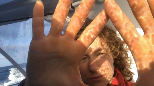 [PHOTO] Les mains abîmées d'Isabelle Joschke