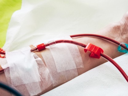 Prise en charge des abords vasculaires - Conférence 13 avril 2023 - NephroCare Béziers