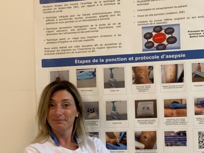 🏠 NephroCare et le développement de la dialyse à domicile Episode #11 -  L’auto-ponction en "Button Hole" pour un patient à domicile 💙