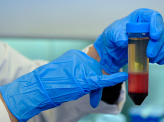 La Fondation d’entreprise Ramsay Générale de Santé réaffirme son engagement dans la recherche scientifique issue du sang de cordon ombilical