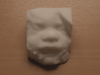 L’échographie tactile 3D pour les futurs parents déficients visuels : une innovation médicale soutenue par la Direction Recherche et Enseignement de Ramsay Santé
