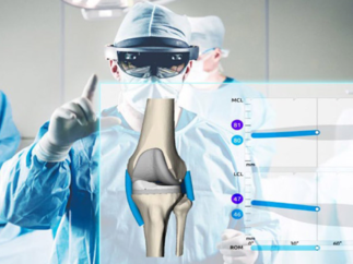 Une première régionale à la Clinique de l’Union : la chirurgie du genou en réalité augmentée