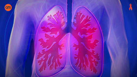 WWorld COPD Day - Buy Medicine Online, Online Pharmacy Noida, Online Medicines, Buy Medicine Online Noida, Nearby Pharmacy, Purchase Medicine Online, GoMedii