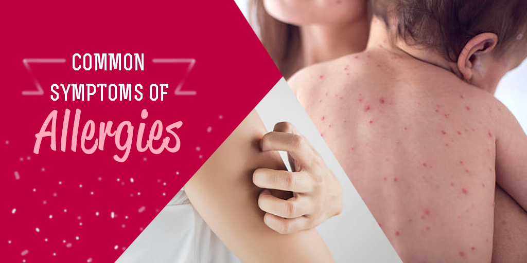 What Are The Common Symptoms of Allergies, Buy Medicine Online, Online Pharmacy Noida, Online Medicines, Buy Medicine Online Noida, Nearby Pharmacy, Purchase Medicine Online, GoMedii