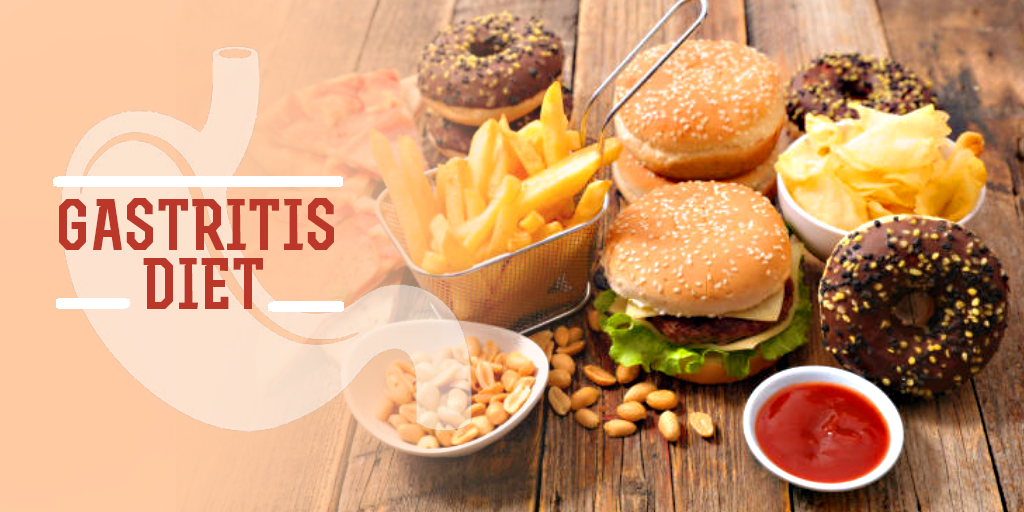 Gastritis Diet, Buy Medicine Online, Online Pharmacy Noida, Online Medicines, Buy Medicine Online Noida, Nearby Pharmacy, Purchase Medicine Online, GoMedii