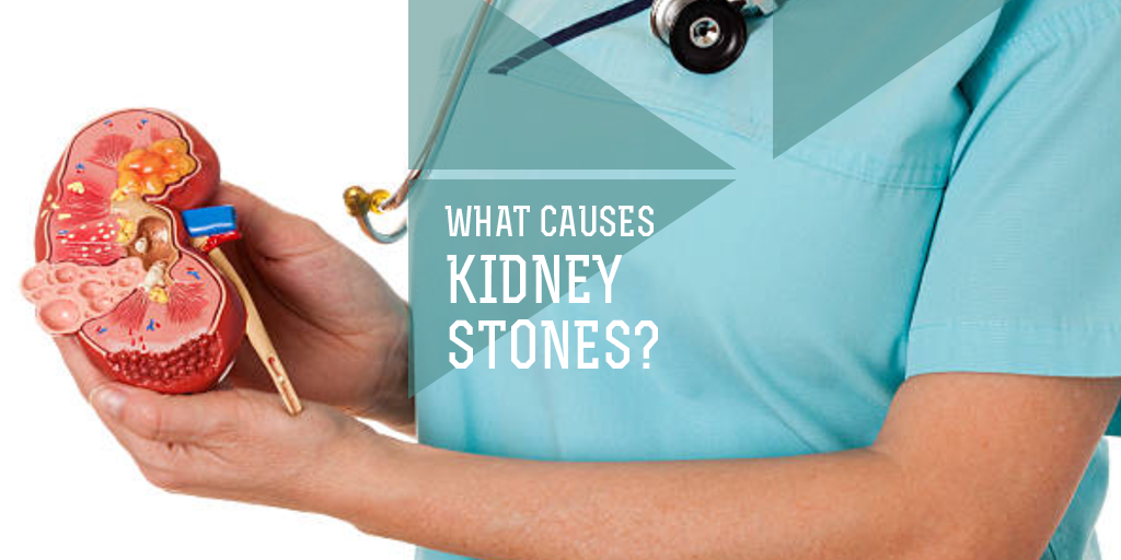 What Causes Kidney Stones, Buy Medicine Online, Online Pharmacy Noida, Online Medicines, Buy Medicine Online Noida, Nearby Pharmacy, Purchase Medicine Online, GoMedii