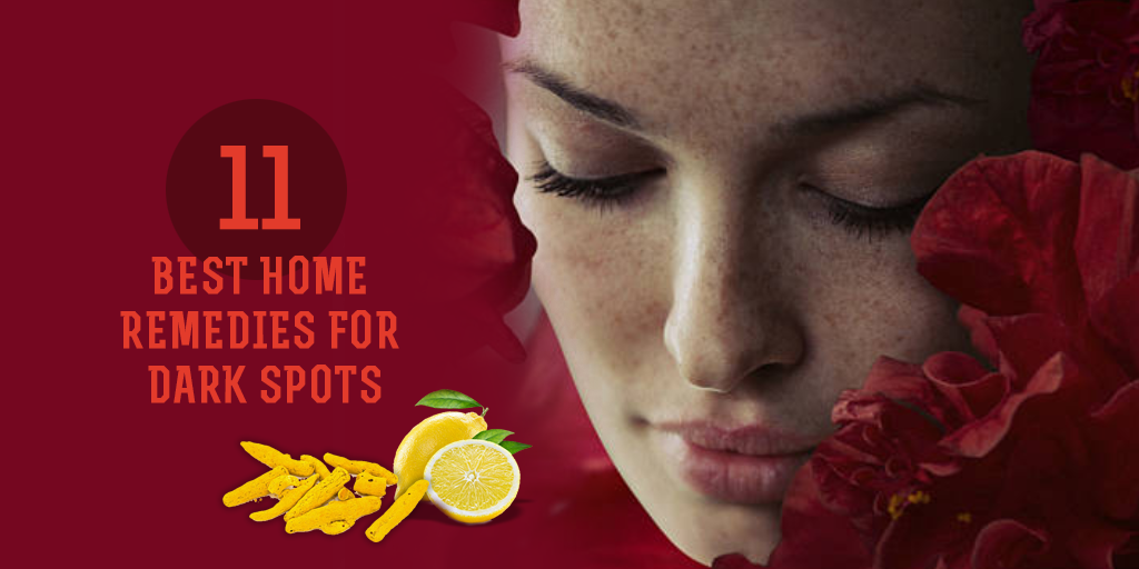 11 Best Home Remedies for Dark Spots, Buy Medicine Online, Online Pharmacy Noida, Online Medicines, Buy Medicine Online Noida, Nearby Pharmacy, Purchase Medicine Online, GoMedii