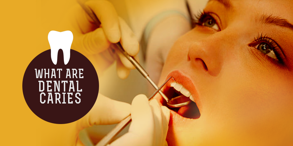 What are Dental Caries, Buy Medicine Online, Online Pharmacy Noida, Online Medicines, Buy Medicine Online Noida, Nearby Pharmacy, Purchase Medicine Online, GoMedii