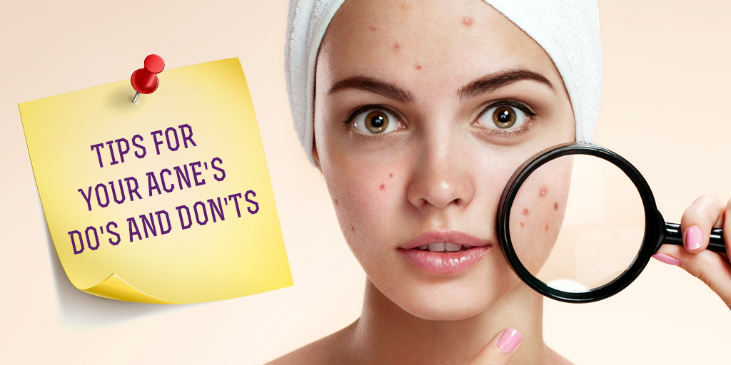 Tips For Your Acne, Buy Medicine Online, Online Pharmacy Noida, Online Medicines, Buy Medicine Online Noida, Nearby Pharmacy, Purchase Medicine Online, GoMedii