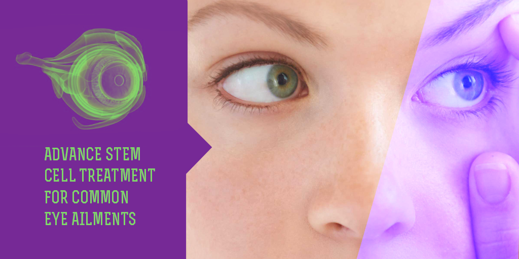 Treatment for Common Eye Ailments, Buy Medicine Online, Online Pharmacy Noida, Online Medicines, Buy Medicine Online Noida, Nearby Pharmacy, Purchase Medicine Online, GoMedii