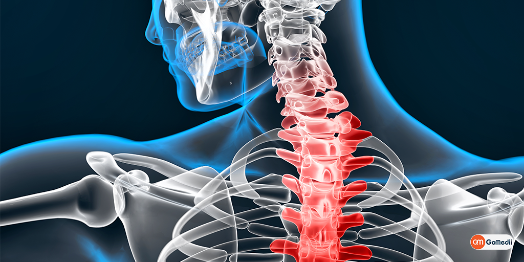 Cervical Spondylosis: Symptoms, Causes, Diagnosis, and Treatment, Order Medicine Online , Online Pharmacy India, Medicine Store, Online Medical Store, Purchase Medicine Online, Medicine Online, Online Pharmacy Noida, Online Chemist Crossing Republic, Online Medicines, Buy Medicine Online India, Online Pharmacy Gaur City