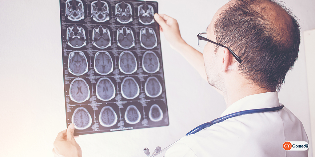 Brain Cancer: Symptoms, Types, Stages & Treatments - GoMedii, Medicines, Online Medicines, Order Medicine Online, Online Pharmacy, Buy Medicine, Purchase Medicine, Medicine Home Delivery, Pharmacy Near Me, Medical Store Near me, Fast Delivery of Medicine, Discount On Medicines, Book Appointment With Doctor, Online Doctor, Doctor Consultation Online, Second Opinion With Doctor