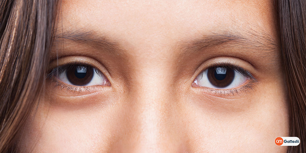 Adie Syndrome: A Neurological Disorder Related to Your Eye, Fast delivery of medicines
