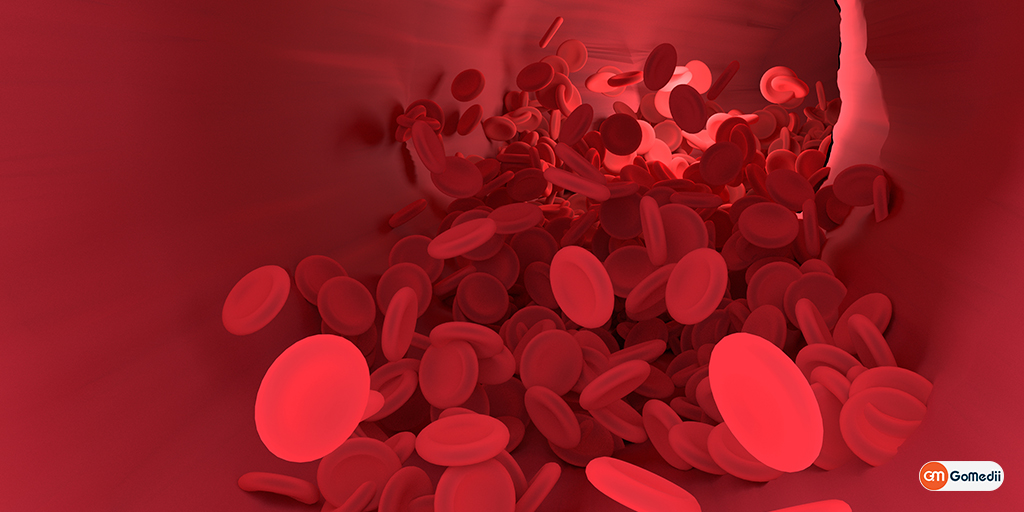 Bloodstream Infection or Bacteremia- How Dangerous It Is?, Medicines, Online Medicines, Order Medicine Online, Online Pharmacy, Buy Medicine, Purchase Medicine, Medicine Home Delivery, Pharmacy Near Me, Medical Store Near me, Fast Delivery of Medicine, Discount On Medicines, Book Appointment With Doctor, Online Doctor, Doctor Consultation Online, Second Opinion With Doctor