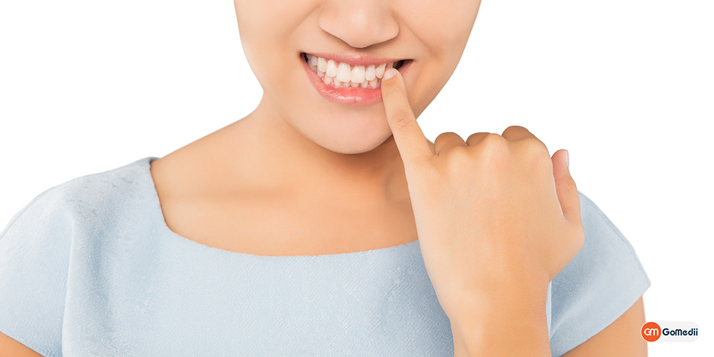 Gum Diseases: Type, Cause, Symptoms & Treatment