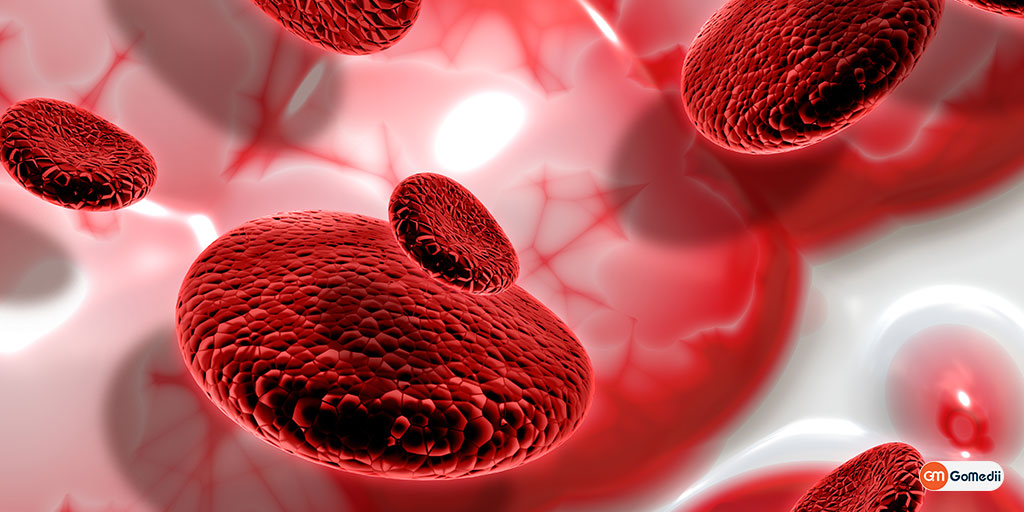 Affordable Thalassemia Treatment in Apollo Hospital
