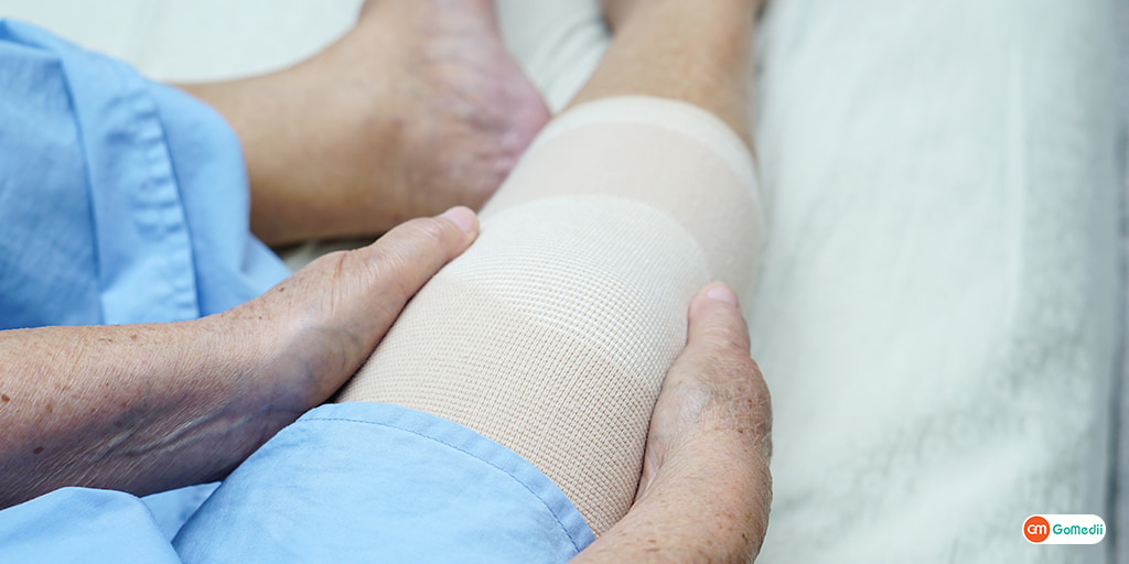 How Long Does a Joint Replacement Last