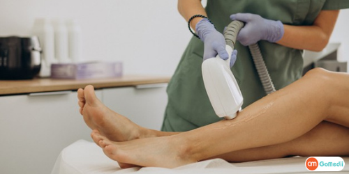 Causes Of Spider Veins, Spider Vein Removal Treatment, Symptoms Of Spider Veins, Sclerotherapy, Laser treatment, Endovenous laser therapy