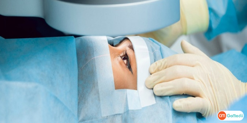 Cataract Surgery Cost, Cataract Surgery, Symptoms Of Cataract, Causes Of Cataract, Types of Cataracts, Treatment For Cataracts, Types Of Cataract Surgery