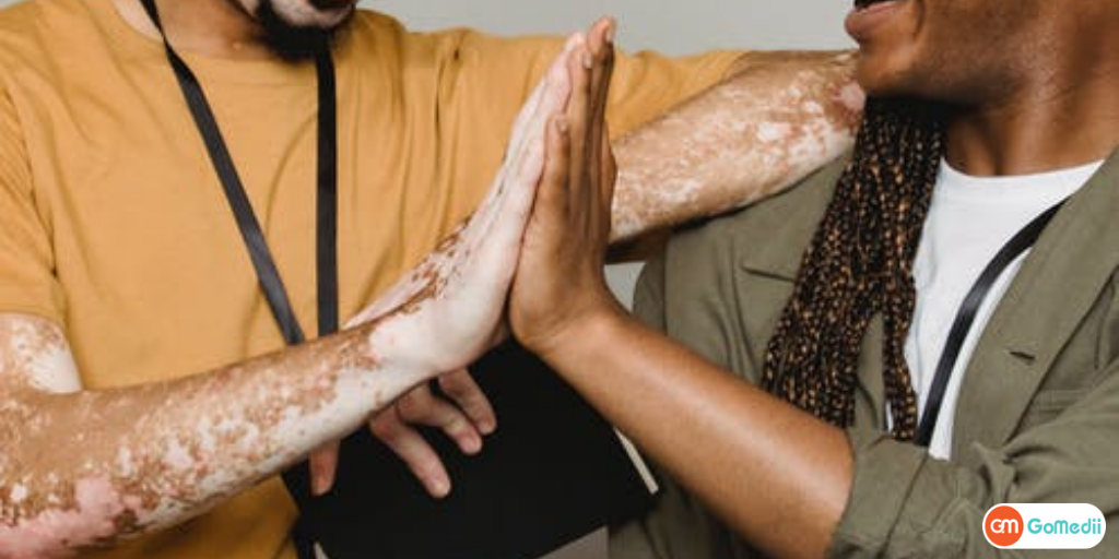 Vitiligo Treatment In India, Causes Of Vitiligo, Complications due to Vitiligo, Diagnosis of vitiligo, Vitiligo Treatment, Cost of Vitiligo Treatment in India, Hospitals for Vitiligo Treatment in India