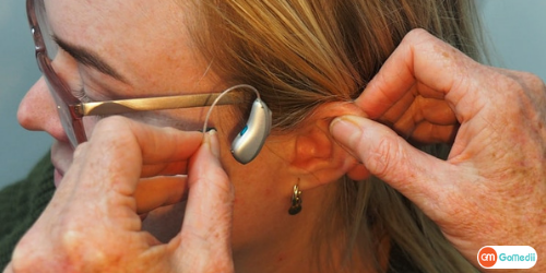 Cochlear Implants In India, Cochlear Implants Surgery In India, Cochlear Implants Cost In India, Cochlear Implants Cost In Delhi, Parts Of Cochlear Implant, Types Of Cochlear Implants