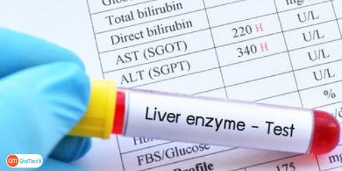 Elevated Liver Enzymes Treatment In India, Causes Elevated Liver Enzymes, Alanine Aminotransferase Test, Liver Enzymes Treatment Hospitals In India