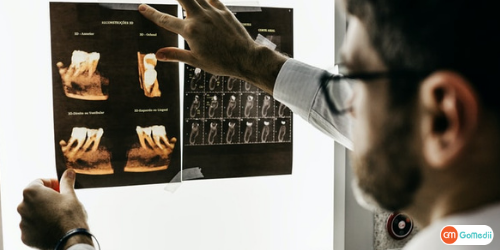  Root Canal Treatment In Lucknow, Root Canal Treatment, stages of root canal treatment, Benefits Of Root Canal Treatment, Root Canal Treatment Hospital In Lucknow