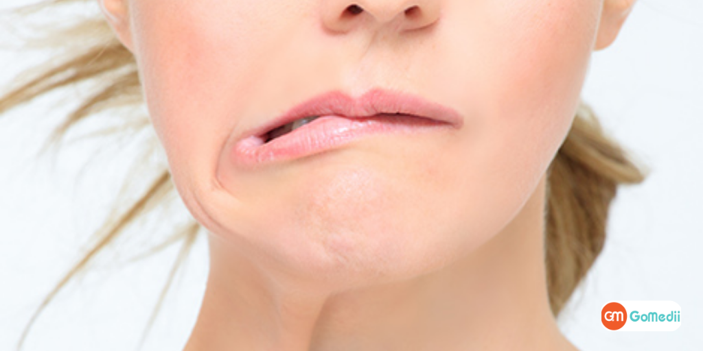 Affordable Facial Paralysis Treatment in Hyderabad, Here It Is-GoMedii
