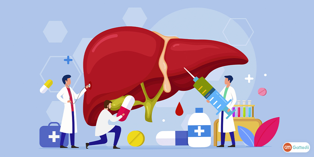 Cost of Liver Transplant In India - GoMedii