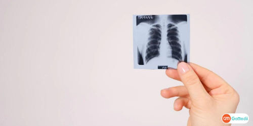 Treatment For Tuberculosis of Liver in Kolkata, Relation Between Tuberculosis and The Liver, Best Hospitals For Tuberculosis Treatment In Kolkata, Liver Tuberculosis Treatment In Kolkata, Stage Of Tuberculosis, Doctor To Diagnose TB