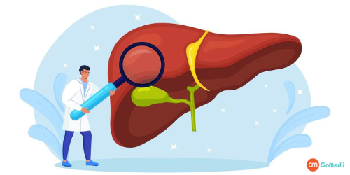 Fatty Liver Treatment In India, Symptoms of liver disease, Alcoholic disease liver disease, Non-alcoholic liver disease Disease, Cost of liver disease treatment in India, Hospitals for liver disease treatment