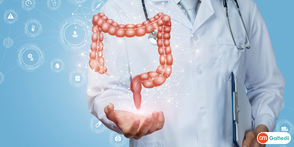 Ulcerative Colitis Treatment In India, Causes Of Ulcerative Colitis, Symptoms Of Ulcerative Colitis, Sign Of Ulcerative Colitis, Diagnose Of Ulcerative Colitis, Cost Of Ulcerative Colitis Treatment in India