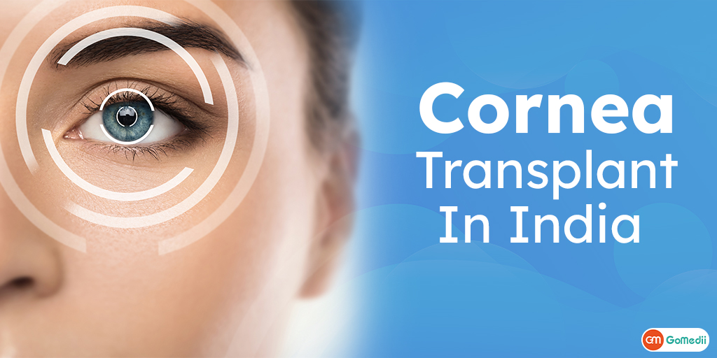 Cornea Transplant In India, Cornea transplant cost in India, hospitals for cornea transplants in India, Questions About Eye Cornea Transplants In India
